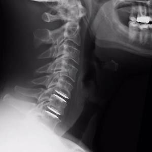 Meet your Posher, Carl